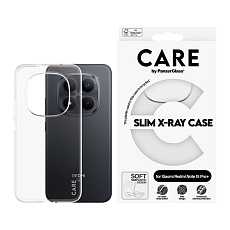 PanzerGlass® CARE X-Ray kryt Xiaomi Redmi Note 15 Pro+ 5G čirý